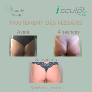 Debody Sculpt I-Sculpt fessiers