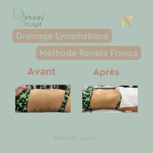 Debody Sculpt Drainage lymphatique Renata França